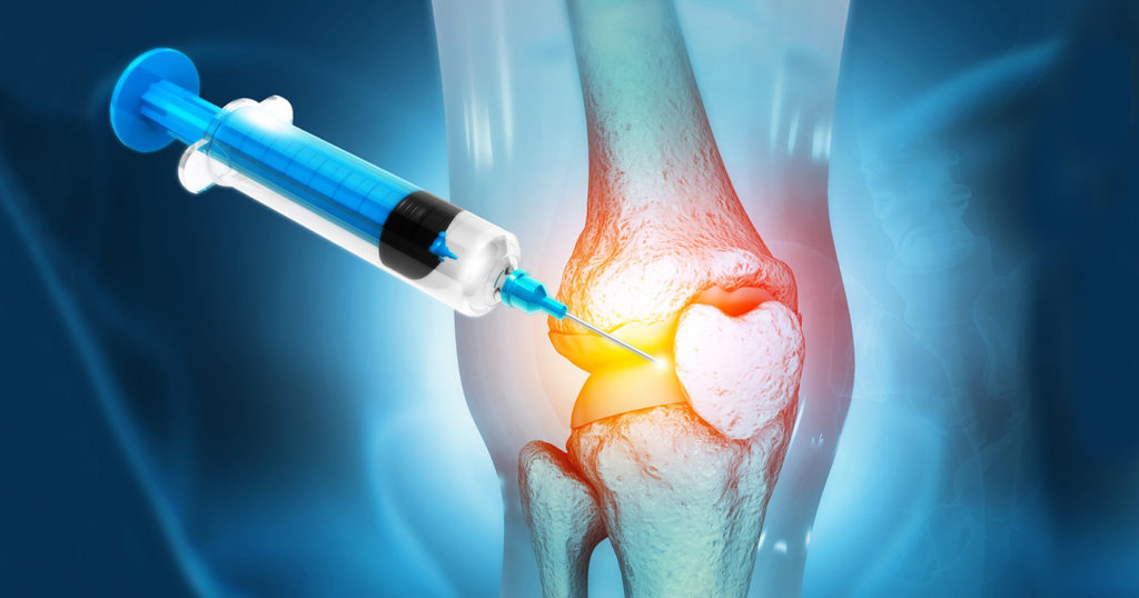 Is Laser Therapy Better for Arthritis than Steroids?