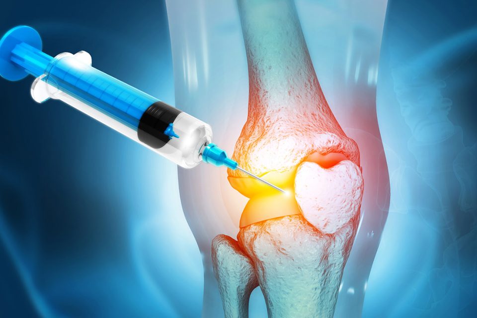 Is Laser Therapy Better for Arthritis than Steroids?