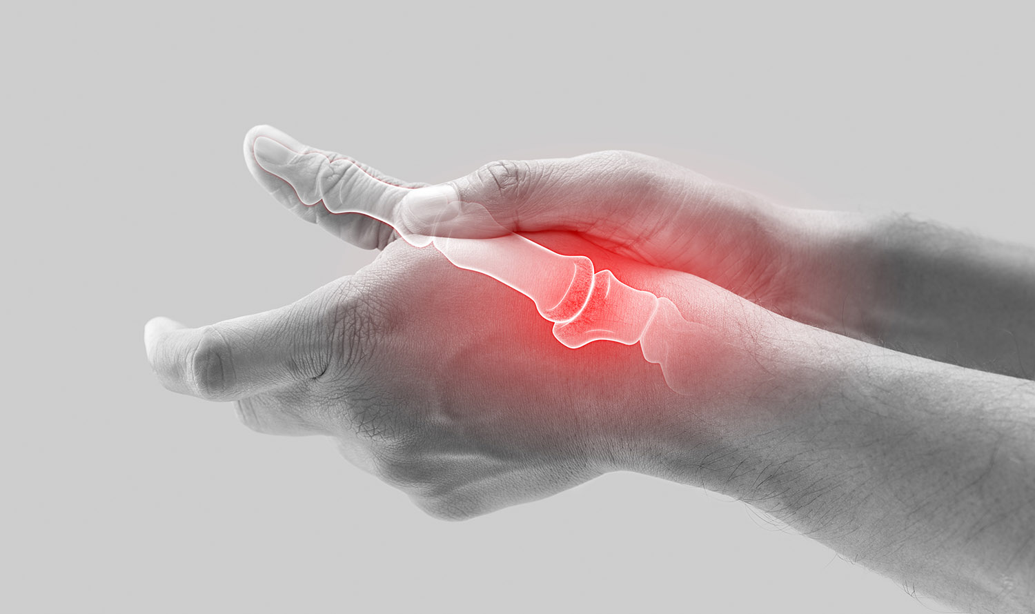 Revolutionizing Treatment Approaches: OrthoLazer's Impact on Arthritis and Neuropathic Pain
